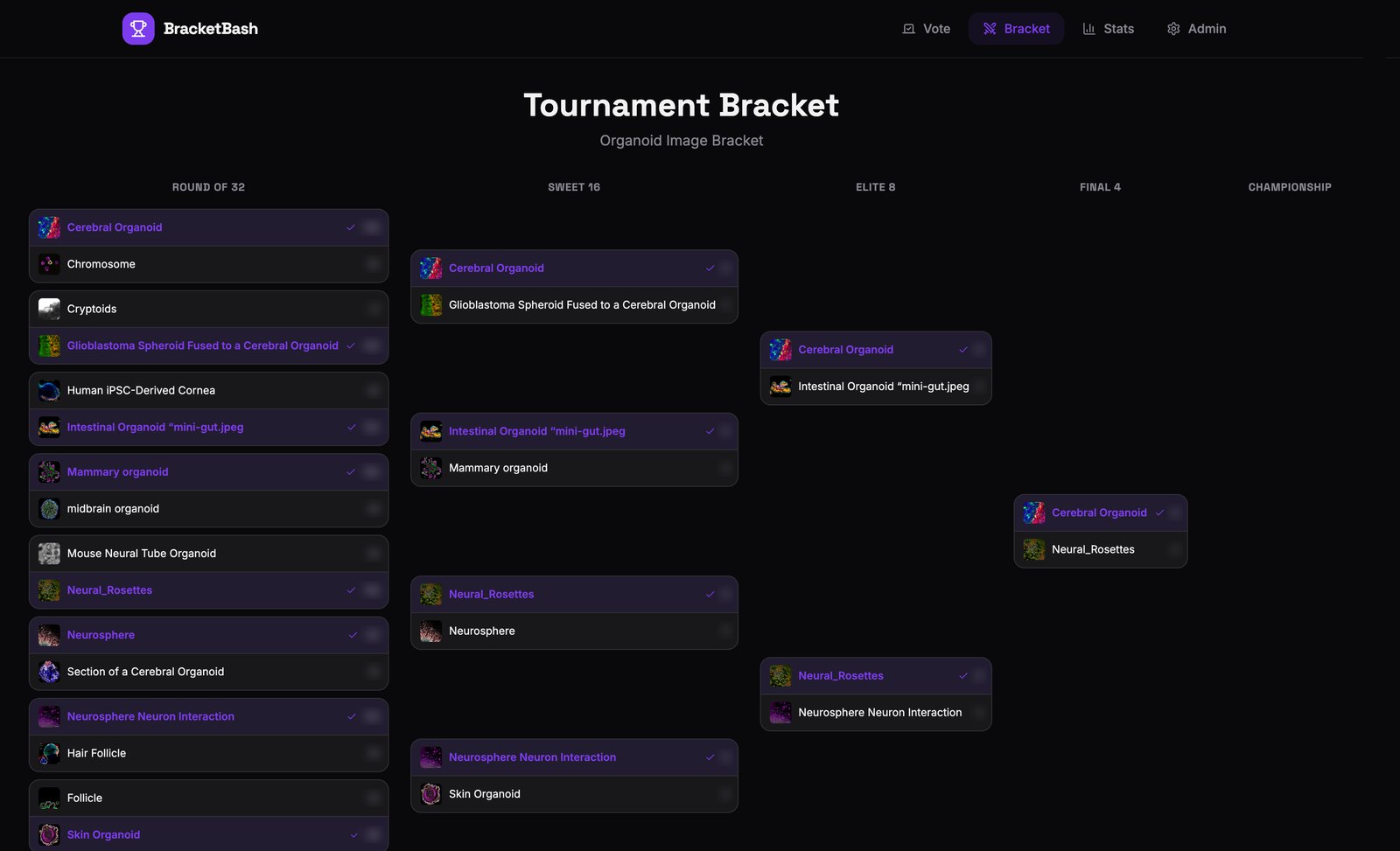 BracketBash tournament bracket for the Organoid Image Bracket, from Round of 32 to Final 4, with organoid images in each matchup. Vote counts are blurred.